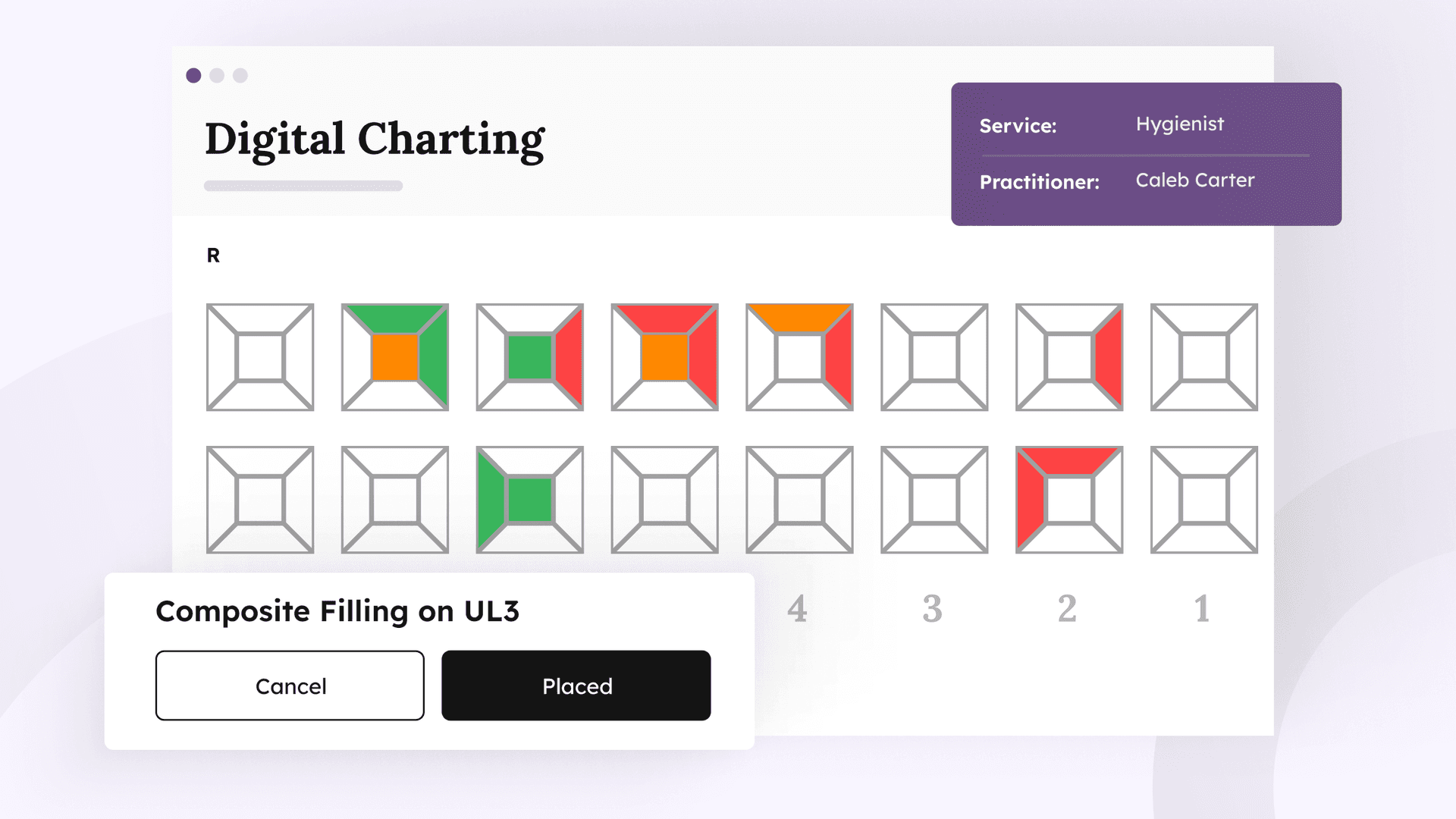 Digital charting interface showing tooth map